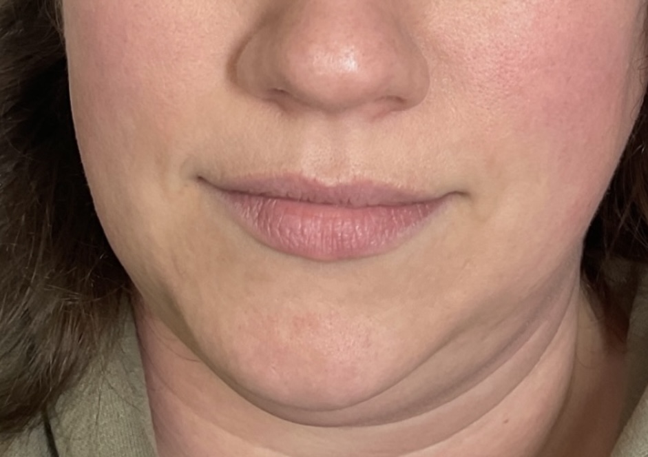 a close up of a person