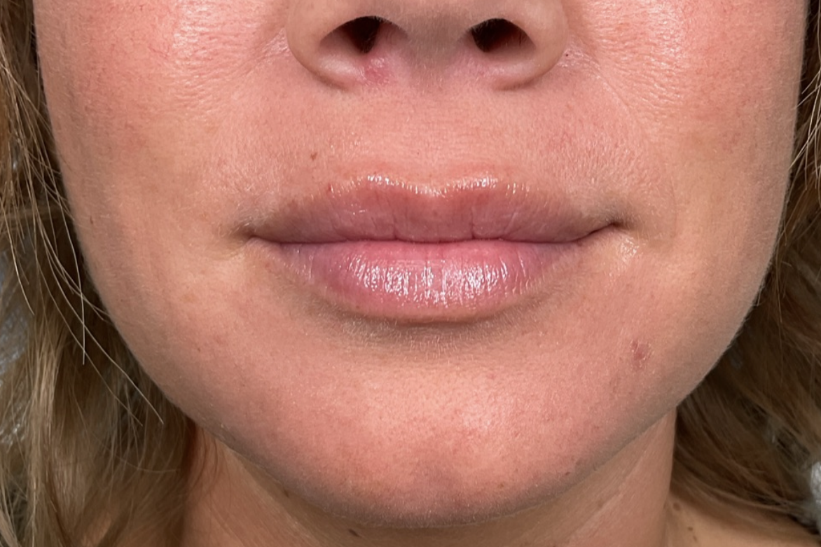 a close up of a person