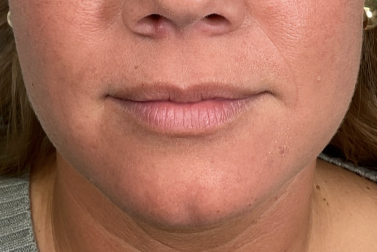 a close up of a man