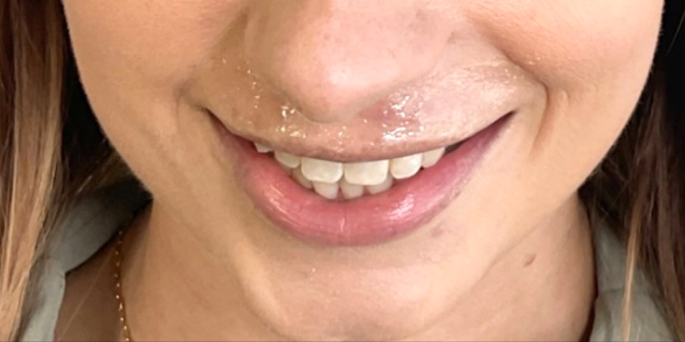 a close up of a woman with her mouth open