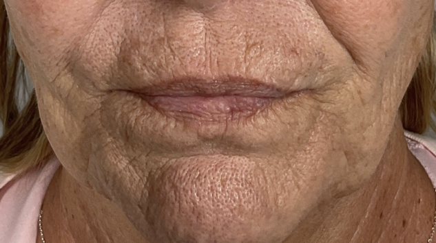 a close up of a man with his mouth open
